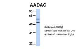 Invitrogen AADAC Polyclonal Antibody 100 &mu;L; Unconjugated:Antibodies,
