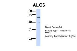 Invitrogen ALG6 Polyclonal Antibody 100 &mu;L; Unconjugated:Antibodies,