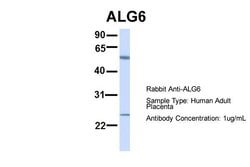 Invitrogen ALG6 Polyclonal Antibody 100 &mu;L; Unconjugated:Antibodies,