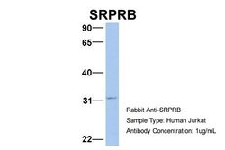 Invitrogen SRPRB Polyclonal Antibody 100 &mu;L; Unconjugated:Antibodies,
