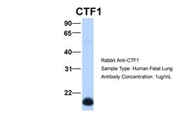 Invitrogen Cardiotrophin 1 Polyclonal Antibody 100 &mu;L; Unconjugated:Antibodies,