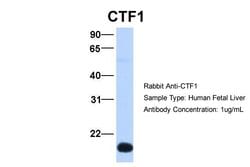 Invitrogen Cardiotrophin 1 Polyclonal Antibody 100 &mu;L; Unconjugated:Antibodies,