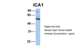 Invitrogen ICA1 Polyclonal Antibody 100 &mu;L; Unconjugated:Antibodies,