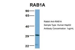 Invitrogen RAB1A Polyclonal Antibody 100 &mu;L; Unconjugated:Antibodies,