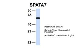 Invitrogen SPATA7 Polyclonal Antibody 100 &mu;L; Unconjugated:Antibodies,
