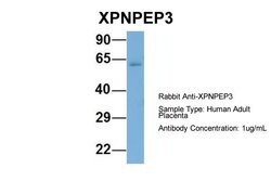 XPNPEP3 Polyclonal Antibody:Antibodies, Polyclonal
