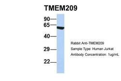 Invitrogen TMEM209 Polyclonal Antibody 100 &mu;L; Unconjugated:Antibodies,