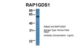 RAP1GDS1 Polyclonal Antibody:Antibodies, Polyclonal