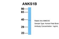 Invitrogen ANKS1B Polyclonal Antibody 100 &mu;L; Unconjugated:Antibodies,