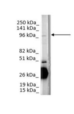 Invitrogen CCDC80 Polyclonal Antibody 100 &mu;L; Unconjugated:Antibodies,
