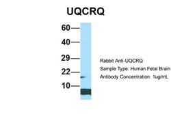 Invitrogen UQCRQ Polyclonal Antibody 100 &mu;L | Buy Online | Invitrogen&trade; | Fisher Scientific