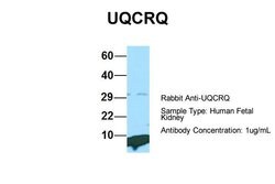 Invitrogen UQCRQ Polyclonal Antibody 100 &mu;L | Buy Online | Invitrogen&trade; | Fisher Scientific
