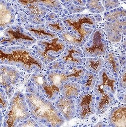 Invitrogen NGAL Polyclonal Antibody 100 &mu;g; Unconjugated:Antibodies,