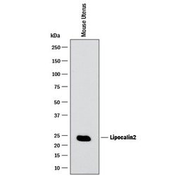 Invitrogen NGAL Polyclonal Antibody 100 &mu;g; Unconjugated:Antibodies,