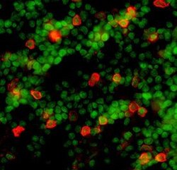 Invitrogen CD25 Polyclonal Antibody 100 &mu;g; Unconjugated:Antibodies,