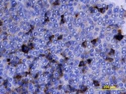 Invitrogen Midkine Polyclonal Antibody 100 &mu;g; Unconjugated:Antibodies,