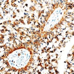 Invitrogen betacellulin Polyclonal Antibody 100 &mu;g | Buy Online | Invitrogen&trade; | Fisher Scientific
