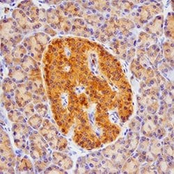 Invitrogen betacellulin Polyclonal Antibody 100 &mu;g | Buy Online | Invitrogen&trade; | Fisher Scientific