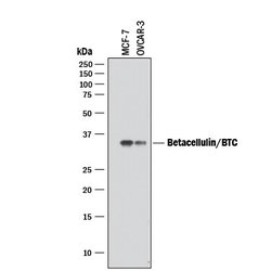 Invitrogen betacellulin Polyclonal Antibody 100 &mu;g | Buy Online | Invitrogen&trade; | Fisher Scientific