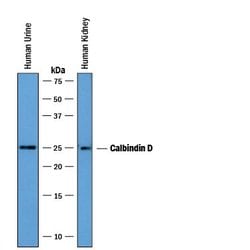 Invitrogen Calbindin D28K Polyclonal Antibody 100 &mu;g; Unconjugated:Antibodies,