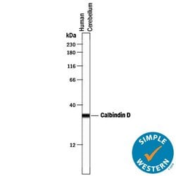 Invitrogen Calbindin D28K Polyclonal Antibody 100 &mu;g; Unconjugated:Antibodies,