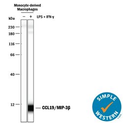 Invitrogen MIP-3 beta Polyclonal Antibody 100 &mu;g | Buy Online | Invitrogen&trade; | Fisher Scientific
