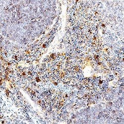 Invitrogen TNF alpha Polyclonal Antibody 100 &mu;g | Buy Online | Invitrogen&trade; | Fisher Scientific