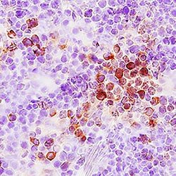 Invitrogen CCL3 Polyclonal Antibody 100 &mu;g; Unconjugated:Anticuerpos