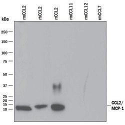 Invitrogen MCP-1 Polyclonal Antibody 100 &mu;g | Buy Online | Invitrogen&trade; | Fisher Scientific