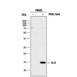 Invitrogen IL-2 Polyclonal Antibody 100 &mu;g; Unconjugated:Antibodies,