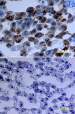Invitrogen CXCL1 Polyclonal Antibody 100 &mu;g; Unconjugated:Antibodies,