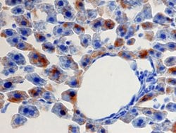 Invitrogen CXCL1 Polyclonal Antibody 100 &mu;g; Unconjugated:Antibodies,