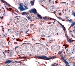 Invitrogen IGFBP4 Polyclonal Antibody 100 &mu;g; Unconjugated:Antibodies,