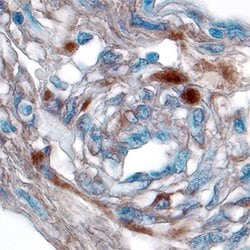 Invitrogen Jagged1 Polyclonal Antibody 100 &mu;g; Unconjugated:Antibodies,
