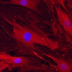 CD105 Polyclonal Antibody:Antibodies, Polyclonal