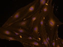 CD105 Polyclonal Antibody:Antibodies, Polyclonal