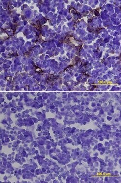 CD105 Polyclonal Antibody:Antibodies, Polyclonal