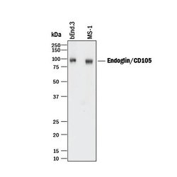 CD105 Polyclonal Antibody:Antibodies, Polyclonal