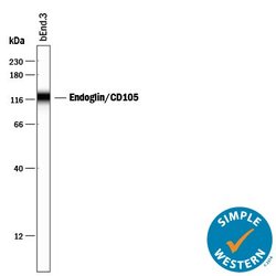 CD105 Polyclonal Antibody:Antibodies, Polyclonal