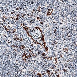 Invitrogen IL-17F Polyclonal Antibody 100 &mu;g; Unconjugated:Antibodies,