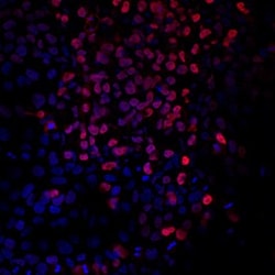 Invitrogen Brachyury Polyclonal Antibody 100 &mu;g; Unconjugated:Antibodies,