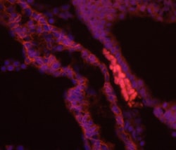 Invitrogen Brachyury Polyclonal Antibody 100 &mu;g; Unconjugated:Antibodies,