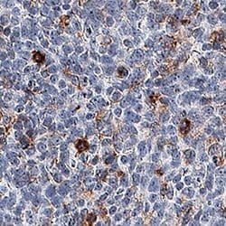 Invitrogen TIM3 Polyclonal Antibody 100 &mu;g; Unconjugated:Antibodies,