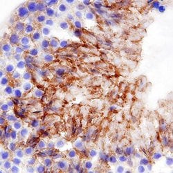 Invitrogen CD206 Polyclonal Antibody 100 &mu;g; Unconjugated:Antibodies,
