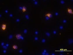Invitrogen CXCL10 Polyclonal Antibody 100 &mu;g; Unconjugated:Antibodies,