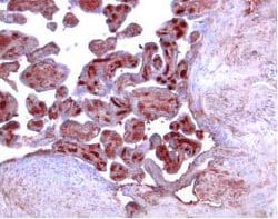 Invitrogen ACVR2B Polyclonal Antibody 100 &mu;g; Unconjugated:Antibodies,