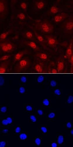Invitrogen IL-33 Polyclonal Antibody 100 &mu;g; Unconjugated:Antibodies,