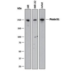 Invitrogen PLXND1 Polyclonal Antibody 100 &mu;g | Buy Online | Invitrogen&trade; | Fisher Scientific