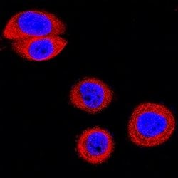 Invitrogen EphB2 Polyclonal Antibody 100 &mu;g; Unconjugated:Antibodies,