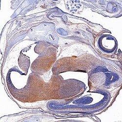 Invitrogen EphB2 Polyclonal Antibody 100 &mu;g; Unconjugated:Antibodies,